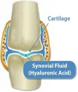 Joint diagram with synovial fluid (hyaluronic acid) – Hyalogic