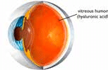 Eye diagram